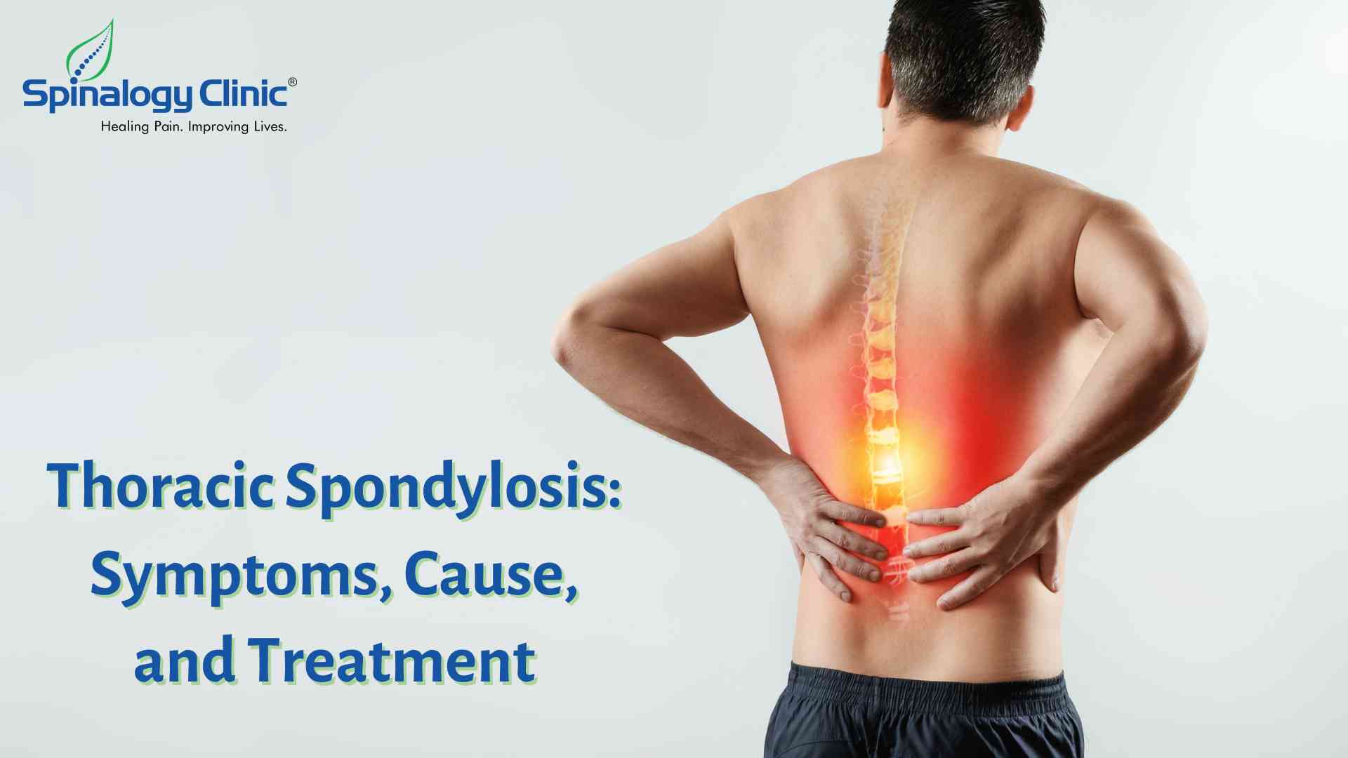 Thoracic Spondylosis: Symptoms, Cause, and Treatment
